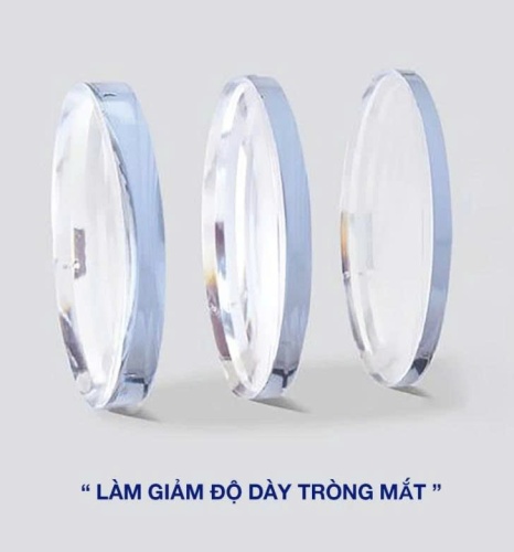 Triết suất 1.90 siêu mỏng dành cho độ cận loạn cao